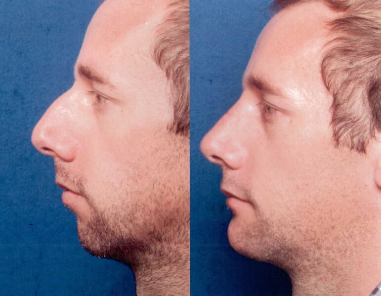 Файл:Jawlines.jpg